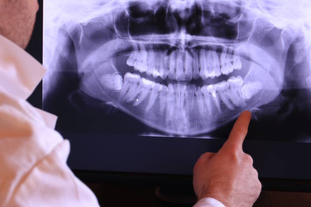 Best Tooth Infection Emergency Dentist  in Ardsley, NY